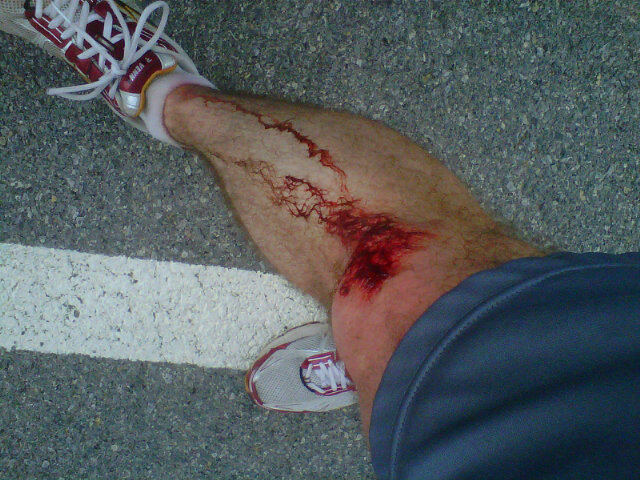 Frozen Toe 10k Frozen Toe 10k